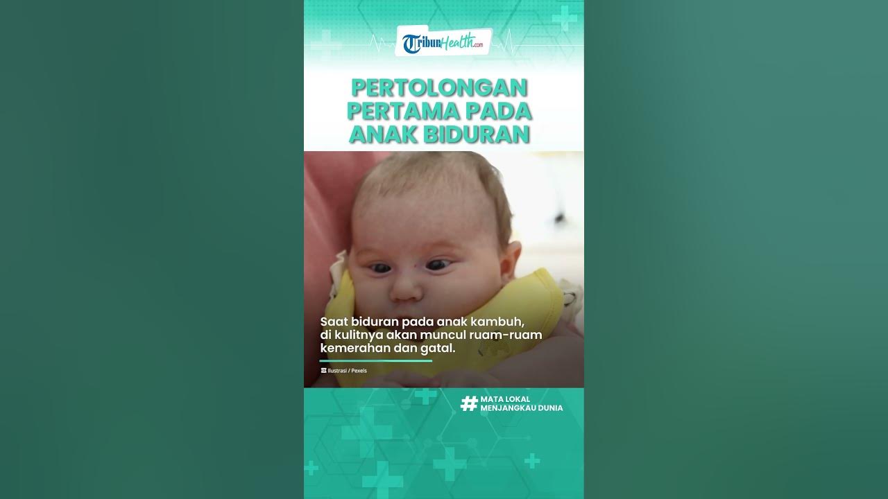 Pertolongan Pertama pada Anak yang Biduran, Bisa Pakai Bahan Alami Ini!