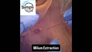 Milium Extraction