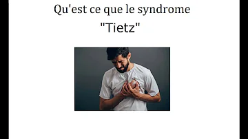 Comment guérir le syndrome de Tietze ?