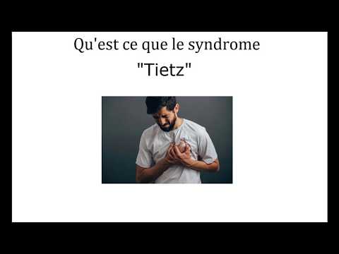 Vidéo: Syndrome De Tietze - Causes, Symptômes, Traitement
