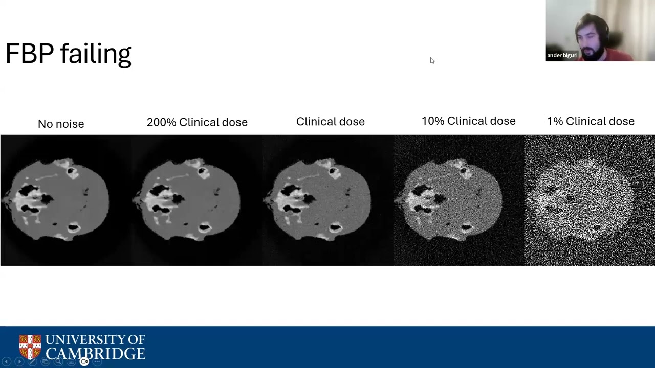 Ander Biguri: Combining the math of inverse problems and ML for CT reconstruction