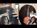 HOW I GREW MY HAIR FAST & BALD SPOT + NATURAL HAIR CARE JOURNEY | KIRAH OMINIQUE