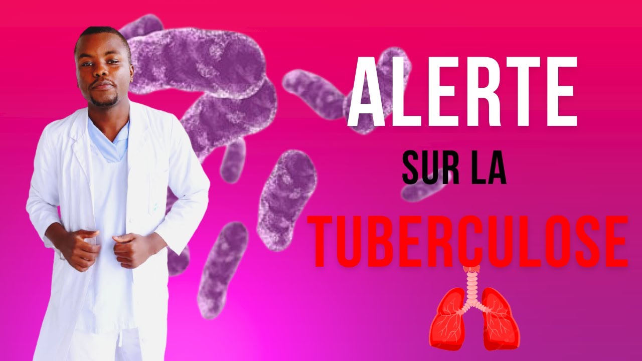 Alerte Sur La Tuberculose