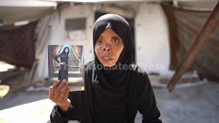 How life-changing war injuries transformed the everyday lives of people in Gaza