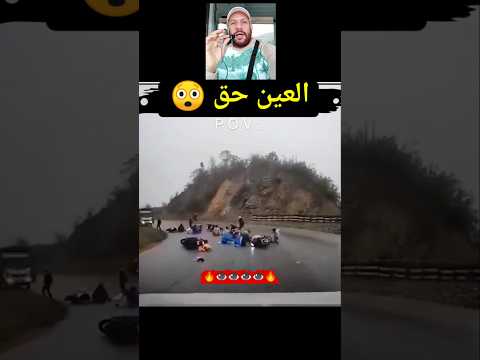 العين حق أصابهم بالعين وبدأ بالغناء
