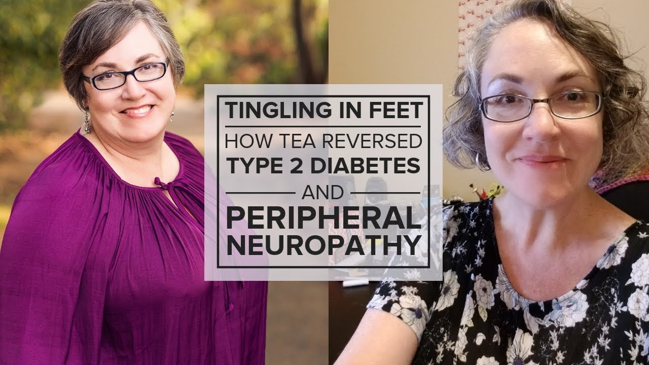 Diabetes 2 Tingling Feet