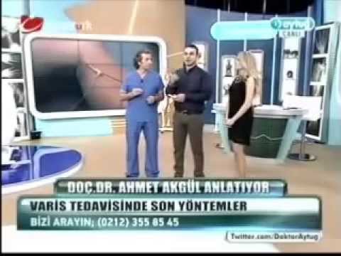 DVT ( Varis Damarı Tıkanıklığı ) Tedavisi - Prof. Dr. Ahmet AKGÜL