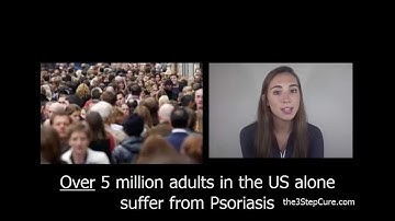 How To Heal Psoriasis Part 1