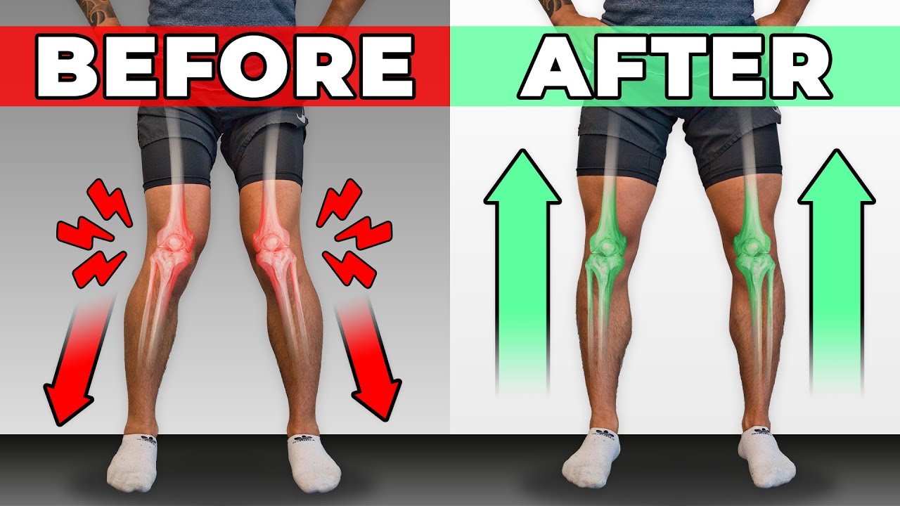 How To Unf*ck Your Knees in 10 Minutes/Day (CORRECTIVE ROUTINE)