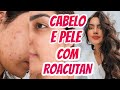 MEU CABELO E PELE TOMANDO ROACUTAN! // Nicole Vieira の動画、YouTube動画。