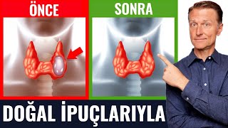 Doğal İpuçlarıyla Tiroid Nodüllerinden Kurtulun | Dr.Berg Türkçe