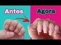 UNHAS ENORMES EM 1 MÊS