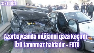 Azərbaycanda müğənni qəza keçirdi - Üzü tanınmaz haldadır + FOTO