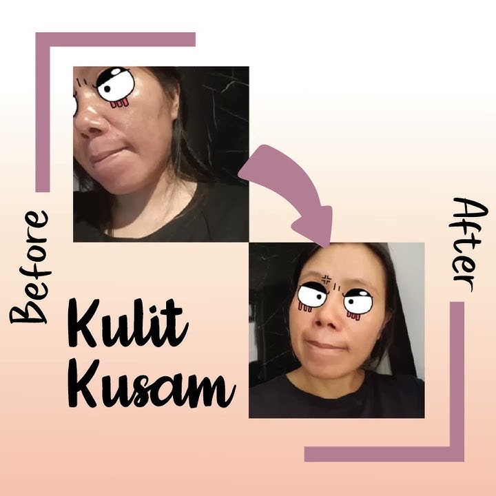 😍 VIRAL! Testimoni M-coll Collagen Candy - Permen Kolagen Terbaik