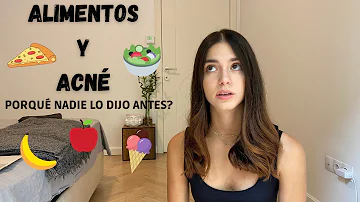 ¿Qué alimentos evitar si tienes la piel propensa al acné?