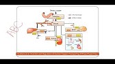 Menkes Kinky Hair Syndrome Youtube
