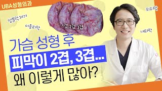 가슴재수술시 이중피막 어떻게 해야할까요??