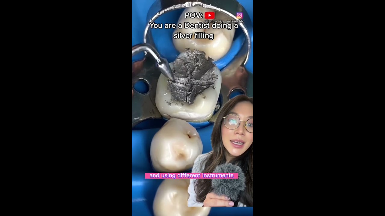Dentist Does A Silver Filling Cavity Silverfilling