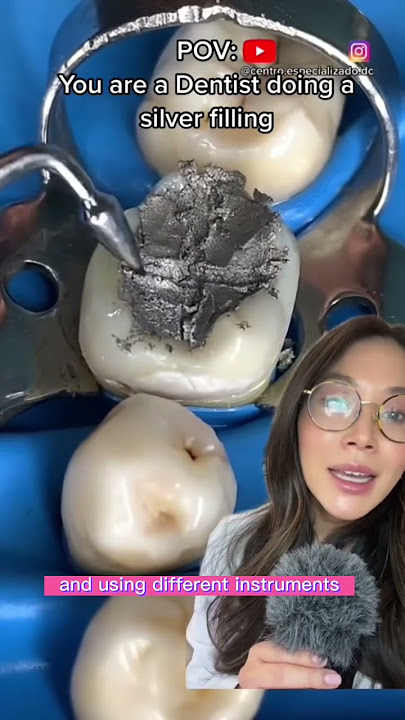 Dentist does a silver filling. #filling #cavity #silverfilling #dentist