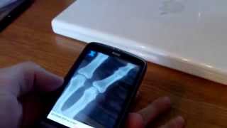 X-Ray Scanner for Android screenshot 5