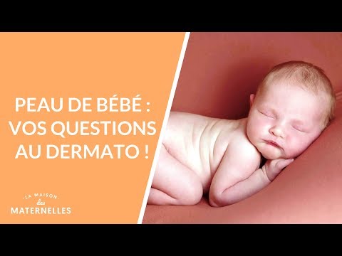 Vidéo: La peau marbrée peut-elle être normale chez les bébés ?