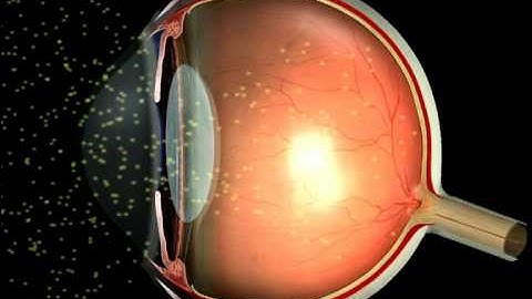 How Vision Works