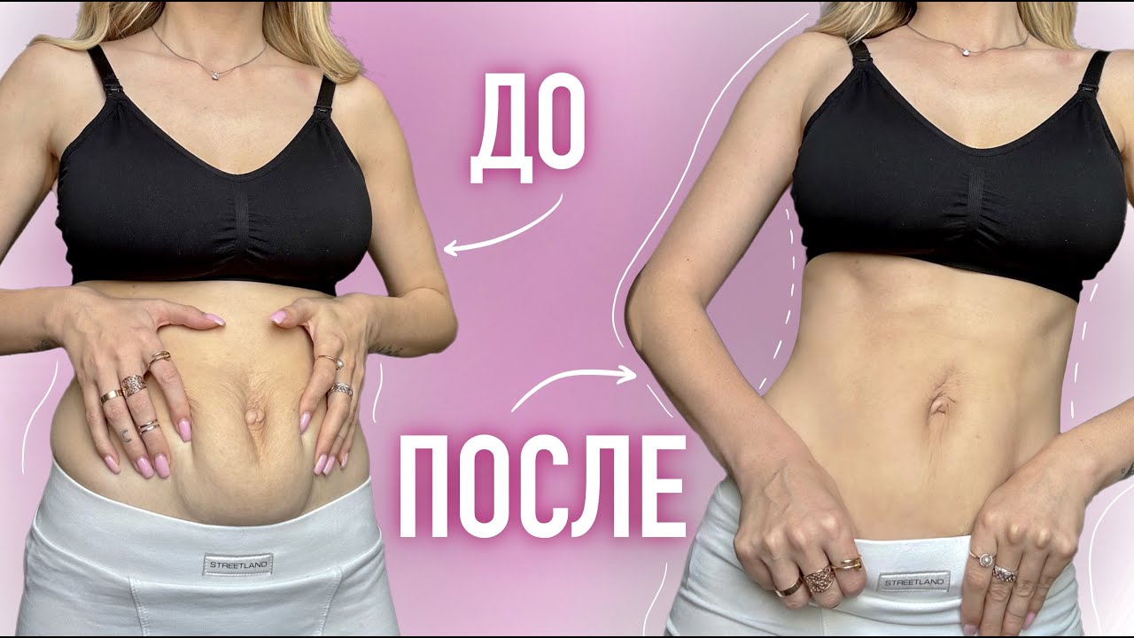 МОЙ УХОД ЗА ТЕЛОМ ПОСЛЕ РОДОВ - YouTube