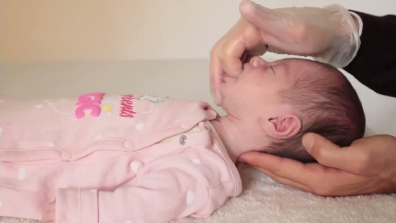 HOW WE FIXED INFANT TONGUE TIE and MOUTH MUSCLE CONTRACTURES causing