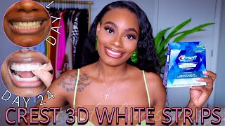 I Tried The Crest 3D White Strips for 24 Days | Quick/Affordable Teeth Whitening | Before & After