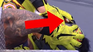 Rey mysterio has his eye removed!!! wwe extreme rules 2020 vs seth
rollins in an for match lost the after rol...