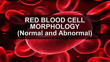 SPC MLS 413 (Hematology 1) RED BLOOD CELL MORPHOLOGY (Normal, Abnormal, Anisocyte, Poikilocyte)