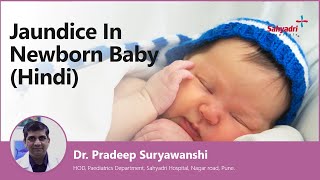 Jaundice In Newborn Baby In Hindi | नवजात शिशु में पीलिया | Dr Pradeep Suryawanshi Sahyadri Hospital