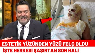 Estetik Yüzünden Tanınmaz Hale Gelen Ünlüler!