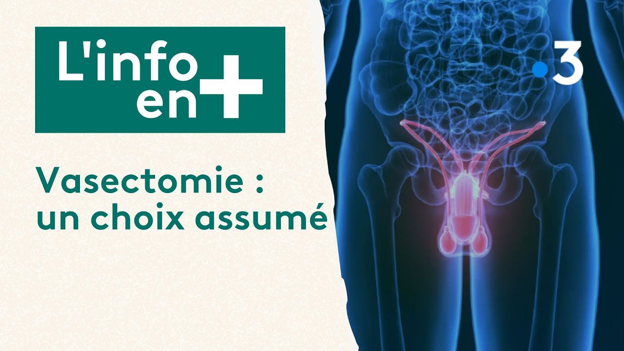 Linfo en plus  Vasectomie un choix assum