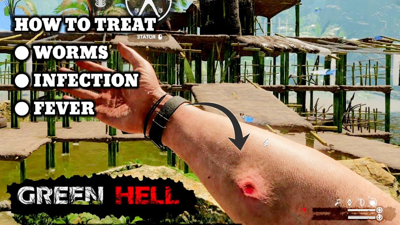 Green Hell How To Treat Worms Infection Fever #Greenhelltips