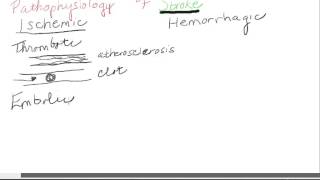 Pathophysiology of Stroke
