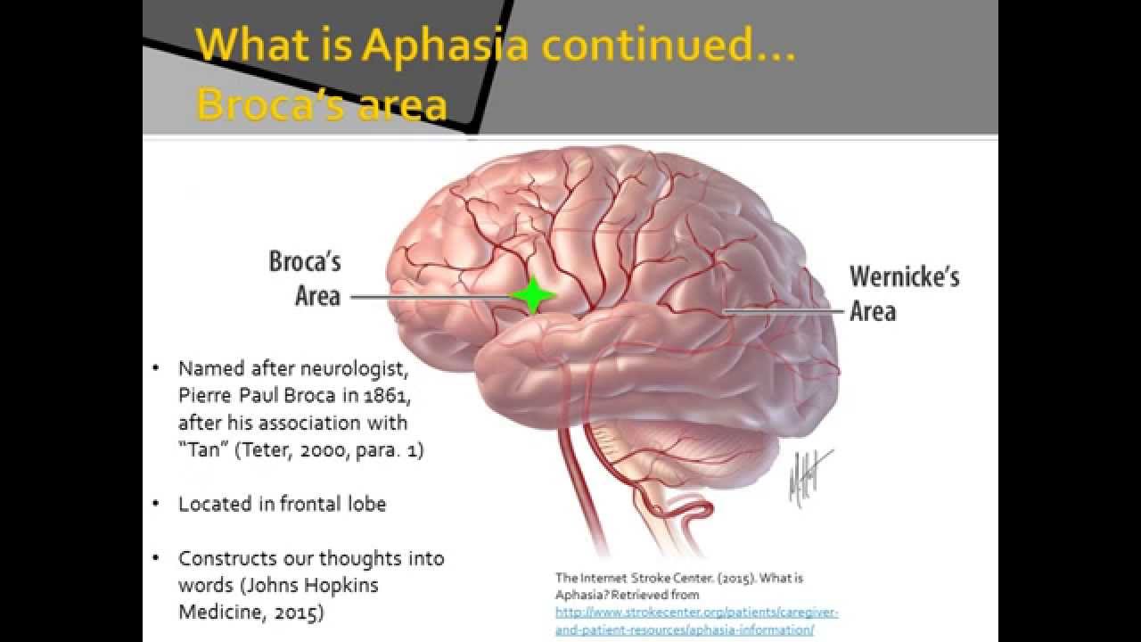 stroke aphasia case study