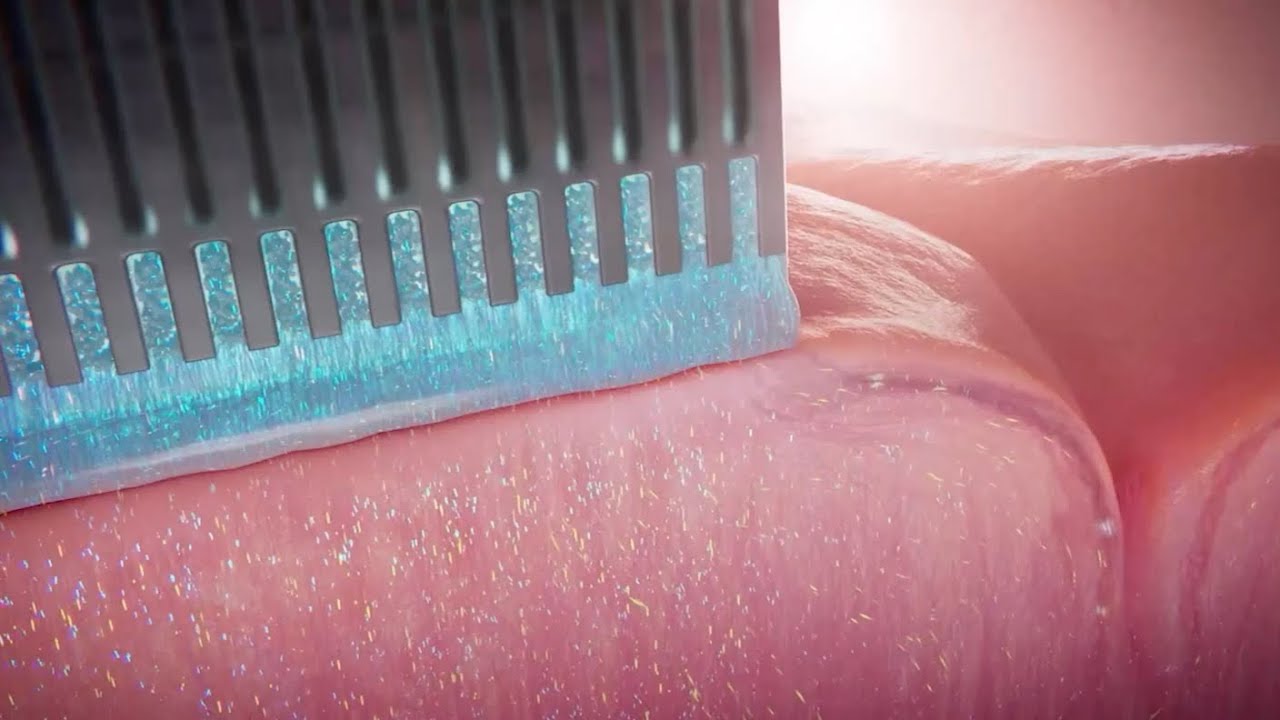 THIS IS THE MOTB: NEW ‘BIO-HYBRID’ IMPLANT CONNECTS TO BRAIN WITH LIVING NEURONS