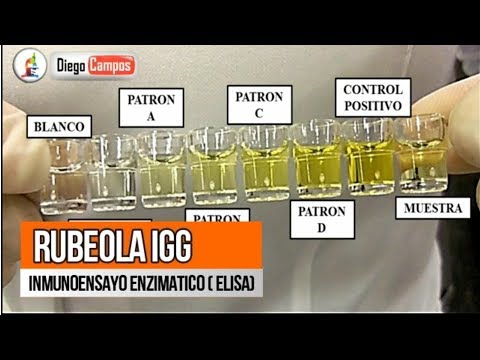 Rubeola anticuerpos igg indeterminado Rubeola anticuerpos igg indeterminado