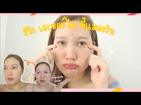 ผลสลากกินแบ่งรัฐบาล วันที่ 1 พย. 2567