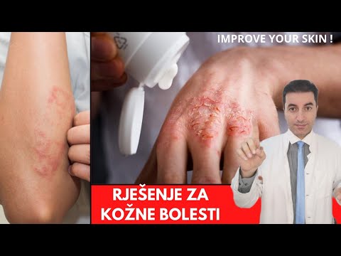 Video: 10 Prírodné spôsoby, ako zmierniť bolesti kĺbov