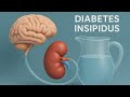 Diabetes insipidus/central versus nephrogenic diabetes insipidus...