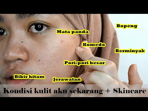 TOP 5 CLEANSERS / Sabun Cuci Muka | suhaysalim. 