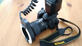 Dental Photography Settings for Nikon Camera DSLR