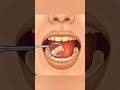 The Most Satisfying ASMR Teeth Cleaning You'll Ever Hear 🦷✨#asmrcleaning #animation