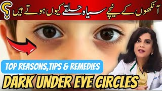 How To Fix Dark Circles Under Your Child's Eyes|Dr.Riffat Omer
