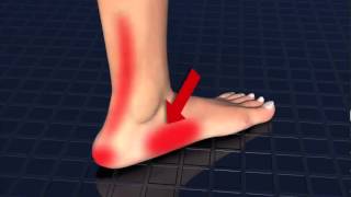 Barefoot Science is the Solution