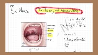 2.5 Nose & Throat l #เตรียมสอบสภาการพยาบาล #test blue print สภาการพยาบาล #การพยาบาลผู้ใหญ่