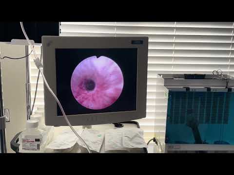 Inside Urology Urethral Stricture Disease
