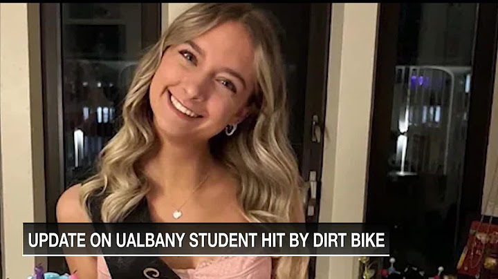 UAlbany student hit by dirt bike wakes up from coma